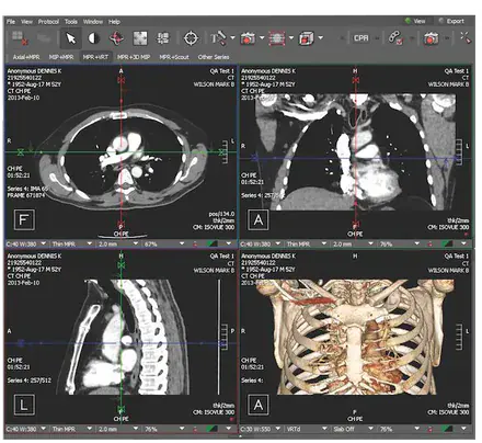 Imagenología - Resonancia, tomografía, ultrasonido y rayos X